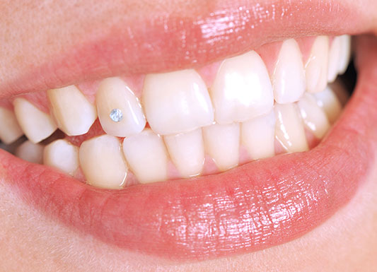 Tooth Jewellery - Wisdom Dental