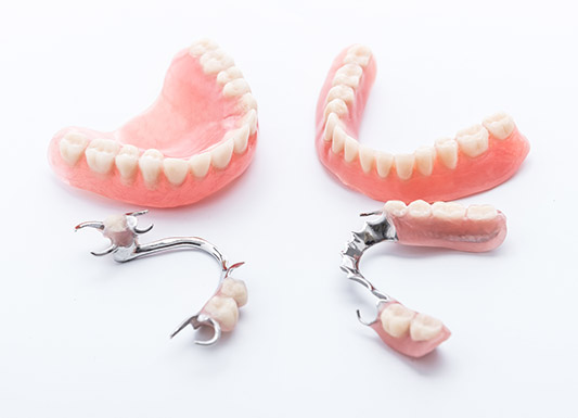 Chrome Dentures - Wisdom Dental